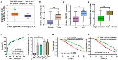 Long Non-coding RNA EBLN3P Regulates UHMK1 Expression by Sponging miR-323a-3p and Promotes Colorectal Cancer Progression